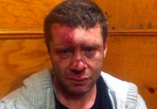 В Одессе под руководством Марка Гординеко жестоко избили человека